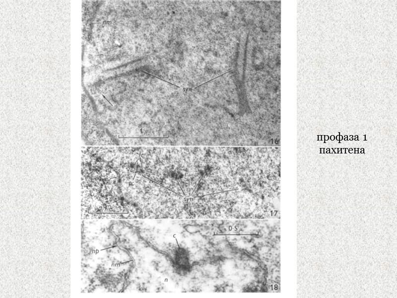 профаза 1 пахитена